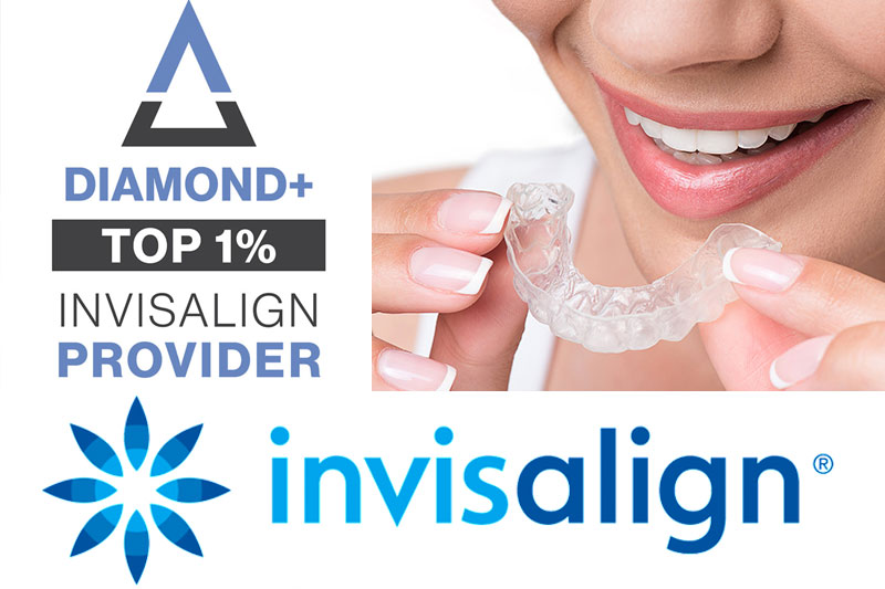 Invisalign in Rocklin