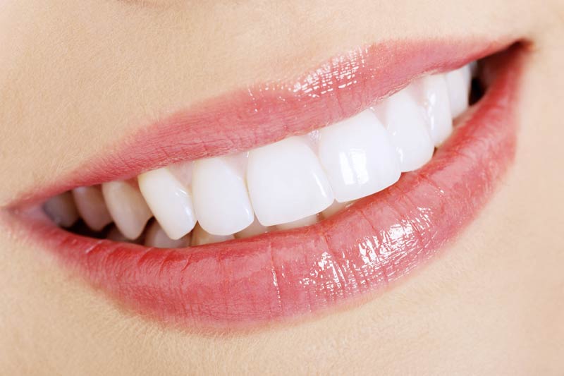 Cosmetic Dentistry in Rocklin