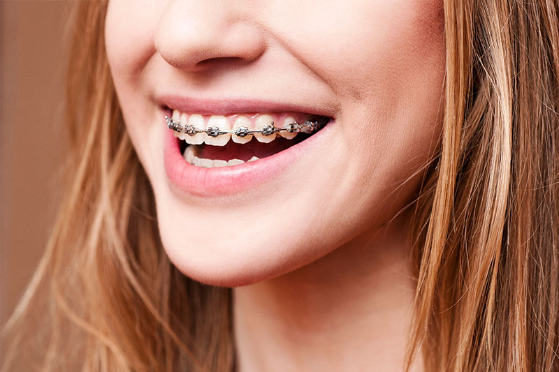 Orthodontics in Rocklin